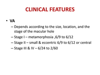 CLINICAL FEATURES
• VA
– Depends according to the size, location, and the
stage of the macular hole
– Stage I – metamorphosia ,6/9 to 6/12
– Stage II – small & eccentric 6/9 to 6/12 or central
– Stage III & IV – 6/24 to 2/60
 