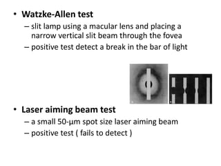 • Watzke-Allen test
– slit lamp using a macular lens and placing a
narrow vertical slit beam through the fovea
– positive test detect a break in the bar of light
• Laser aiming beam test
– a small 50-µm spot size laser aiming beam
– positive test ( fails to detect )
 