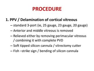 PROCEDURE
1. PPV / Delamination of cortical vitreous
– standard 3-port (ie, 25 gauge, 23 gauge, 20 gauge)
– Anterior and middle vitreous is removed
– Relieved either by removing perimacular vitreous
/ combining it with complete PVD
– Soft tipped silicon cannula / vitrectomy cutter
– Fish –strike sign / bending of silicon cannula
 