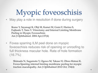 Myopic foveoschisis
• May play a role in resolution if done during surgery
Ikuno Y, Sayanagi K, Ohji M, Kamei M, Gomi F, Harino S,
Fujikado T, Tano Y. Vitrectomy and Internal Limiting Membrane
Peeling in Myopic Foveoschisis
Am J Ophthalmol. 2004 Apr;137(4)
• Fovea sparring ILM peel done on myopic
foveoschisis reduces risk of opening or unroofing to
full thickness macular hole. Rate of hole formation
(16.7%)
Shimada N, Sugamoto Y, Ogawa M, Takase H, Ohno-Matsui K.
Fovea-Sparring internal limiting membrane peeling for myopic
traction maculopathy. Am J Ophthalmol 2012 Oct; 154(4)
 