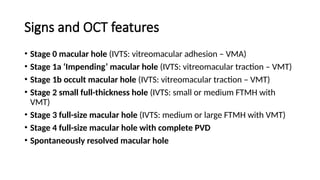 macular hole .pptx prensnter from Bangladesh | PPTX