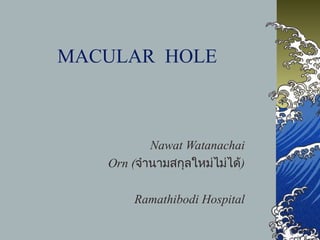 MACULAR HOLE

Nawat Watanachai
Orn (จำำนำมสกุลใหม่ไม่ได้)
Ramathibodi Hospital

 