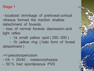 Stage 1
- localized shrinkage of prefoveal cortical
vitreous formed the traction shallow
detachment of foveola
- loss of normal foveola depression and
light reflex
- 1a small yellow spot ( 250 -300 )
- 1b yellow ring ( halo form of foveal
detachment )
-+/-pseudooperculum
- VA < 20/40 , metamorphopsia
- 50 % had spontaneous PVD

 