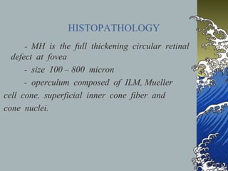 HISTOPATHOLOGY
- MH is the full thickening circular retinal

defect at fovea
- size 100 – 800 micron
- operculum composed of ILM, Mueller
cell cone, superficial inner cone fiber and
cone nuclei.

 