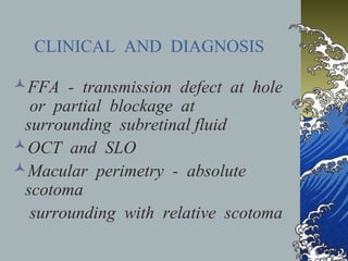 CLINICAL AND DIAGNOSIS
FFA - transmission defect at hole
or partial blockage at
surrounding subretinal fluid
OCT and SLO
Macular perimetry - absolute
scotoma
surrounding with relative scotoma

 