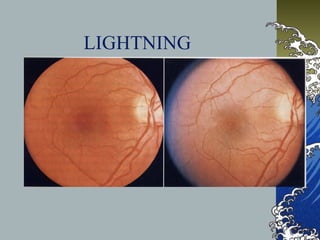 LIGHTNING

 