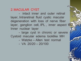 2. MACULAR CYST
- intact inner and outer retinal
layer, Intraretinal fluid cystic macular
degeneration with loss of nerve fiber
layer, ganglion cell, IPL , inner aspect of
Inner nuclear layer
- large cyst in chronic or severe
Cystoid macular edema looklike MH
- Watzke – Allen test normal
- VA 20/20 – 20/100

 