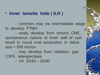• Inner lamella hole ( ILH )
- common, may be intermediate stage
to develop FTMH
- rarely develop from chronic CME,
spontaneous rupture at inner wall of cyst
result in round oval excavation in retina
size < 500 micron
- may develop from radiation, gas
C3F8, telangiectasia
- VA 20/20 – 20/80

 