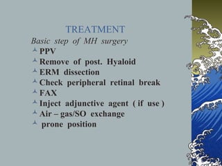 TREATMENT
Basic step of MH surgery
 PPV
 Remove of post. Hyaloid
 ERM dissection
 Check peripheral retinal break
 FAX
 Inject adjunctive agent ( if use )
 Air – gas/SO exchange
 prone position

 