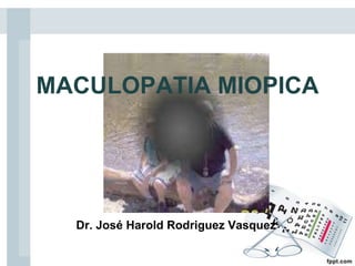 MACULOPATIA MIOPICA
Dr. José Harold Rodriguez Vasquez
 