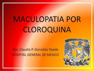 c MACULOPATIA POR CLOROQUINA Dra. Claudia P. González Tejeda HOSPITAL GENERAL DE MEXICO 