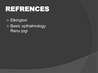 REFRENCES
Elkington
Basic opthalmology
Renu jogi