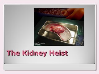 The Kidney Heist