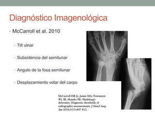 Diagnóstico Imagenológica
• McCarroll et al. 2010
• Tilt ulnar
• Subsidencia del semilunar
• Angulo de la fosa semilunar
• Desplazamiento volar del carpo
 