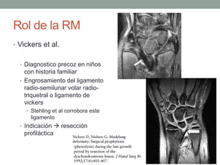 Rol de la RM
• Vickers et al.
• Diagnostico precoz en niños
con historia familiar
• Engrosamiento del ligamento
radio-semilunar volar radio-
triquetral o ligamento de
vickers
• Stehling et al corrobora este
ligamento
• Indicación  resección
profiláctica
 