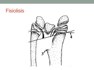 Fisiolisis
 