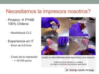 Necesitamos la impresora nosotros?
• Protaico  PYME
100% Chilena
• Maxilofacial CLC
• Experiencia en IT
• Error de 0,01mm
• Costo de la impresión
• +- 80.000 pesos
 