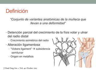 Definición
“Conjunto de variantes anatómicas de la muñeca que
llevan a una deformidad”
• Detención parcial del crecimiento de la físis volar y ulnar
del radio distal
• Crecimiento asimétrico del radio
• Alteración ligamentosa
• “Vickers ligament”  subsidencia
semilunar
• Origen en metáfisis
 