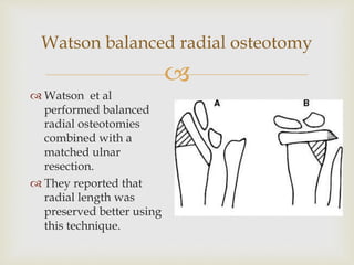 
Watson balanced radial osteotomy
 Watson et al
performed balanced
radial osteotomies
combined with a
matched ulnar
resection.
 They reported that
radial length was
preserved better using
this technique.
 