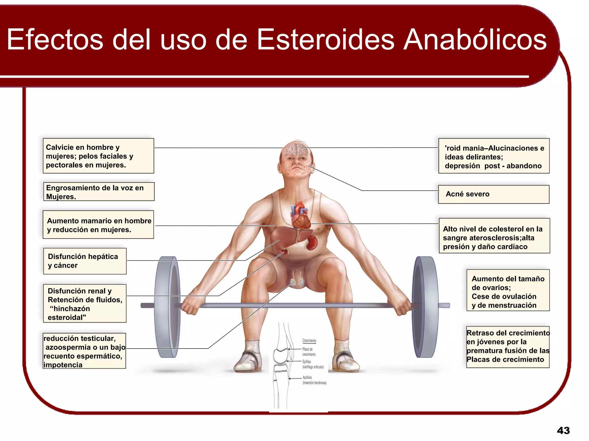 Efectos del uso de Esteroides Anabólicos


  Calvicie en hombre y          'roid mania–Alucinaciones e
  mujeres; pelos faciales y     ideas delirantes;
  pectorales en mujeres.        depresión post - abandono


  Engrosamiento de la voz en
  Mujeres.                      Acné severo


   Aumento mamario en hombre
   y reducción en mujeres.      Alto nivel de colesterol en la
                                sangre aterosclerosis;alta
                                presión y daño cardíaco
   Disfunción hepática
   y cáncer
                                        Aumento del tamaño
   Disfunción renal y                   de ovarios;
   Retención de fluidos,                Cese de ovulación
   “hinchazón                           y de menstruación
   esteroidal"

                                       Retraso del crecimiento
  reducción testicular,                en jóvenes por la
   azoospermia o un bajo               prematura fusión de las
  recuento espermático,                Placas de crecimiento
  impotencia




                                                                 43
 