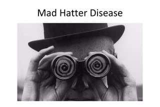 Mad Hatter Disease
 