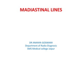 MADIASTINAL LINES
DR ANANYA GOSWAMI
Department of Radio Diagnosis
SMS Medical college Jaipur
 