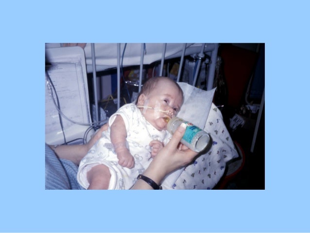 side lying feeding bottle