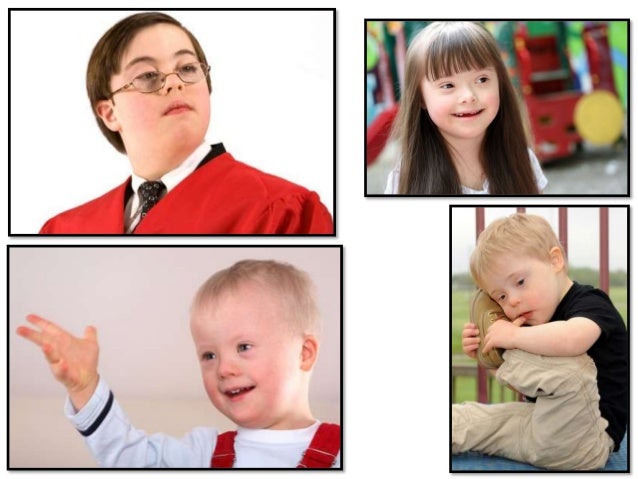 Mental Retardation/Intellectual Disability: Definition and ...