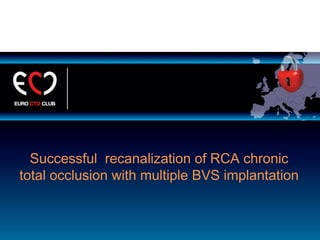 Successful recanalization of RCA chronic
total occlusion with multiple BVS implantation
 