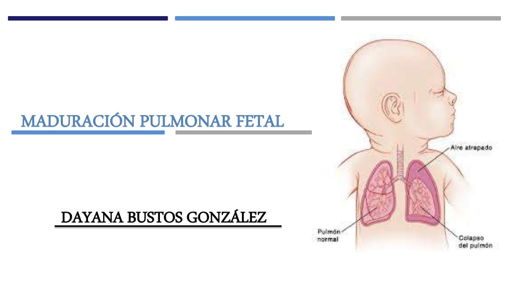 Maduracion pulmonar fetal