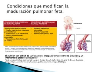 Tabla: Estandarizacion de pruebas de maduración pulmonar fetal en el hospital de especialidades
del niño y la mujer, universidad autonoma de queretaro facultad de medicina, especialidad de
ginecologia y obstetricia presenta dra. Silvia lorena ortega berumen, dirigido por dr.especialista
virgilio humberto saucedo rogel)
El pulmón con déficit de surfactante es incapaz de mantener una aireación y un
intercambio gaseoso adecuados.*
*Síndrome de dificultad respiratoria J. López de Heredia Goya, A. Valls i Soler. Hospital de Cruces. Barakaldo
Imagen: https://www.fairview.org/fv/groups/public/documents/images/87089.jpg
CONDICIONES QUE ACELERAN LA
MADUREZ PULMONAR
CONDICIONES QUE RETRASAN LA
MADUREZ PULMONAR
-Hipertensión arterial crónica
- Estados hipertensivos inducidos
por el embarazo
- Restricciones en el crecimiento
- Ruptura de membranas
prolongada
- Tabaquismo, alcoholismo, uso
de cocaína
- Diabetes mellitus no
controlada
- Isoinmunizacion Rh
- Hernia diafragmática fetal
 