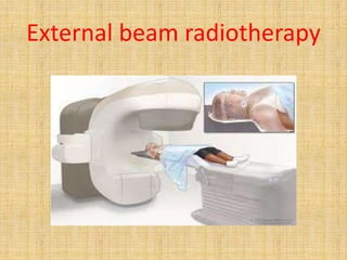 External beam radiotherapy
 