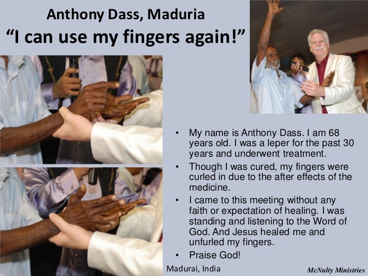 Anthony Dass, Maduria“I can use my fingers again!” • My name is Anthony Dass. I am 68 ...