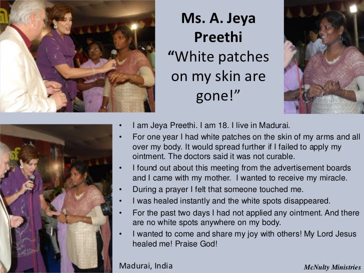 Ms. A. Jeya Preethi “White patches on my skin are gone!”• I am Jey...