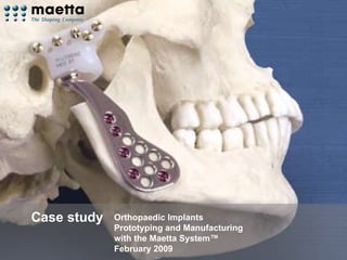 Orthopaedic Implants  Prototyping and Manufacturing with the Maetta System™ February 2009 Case study 