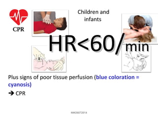 Plus signs of poor tissue perfusion (blue coloration =
cyanosis)
 CPR
HR<60/HR<60/minmin
Children and
infants
NW26072014
 
