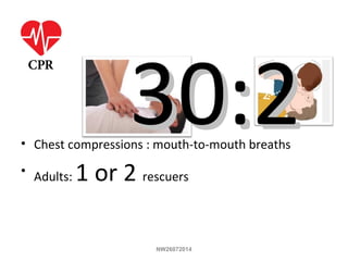 30:230:2• Chest compressions : mouth-to-mouth breaths
• Adults: 1 or 2 rescuers
NW26072014
 