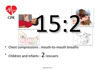• Chest compressions : mouth-to-mouth breaths
• Children and infants : 2rescuers
15:215:2
NW26072014
 
