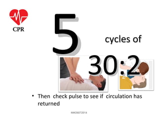 55
NW26072014
cycles ofcycles of
30:230:2
• Then check pulse to see if circulation has
returned
 