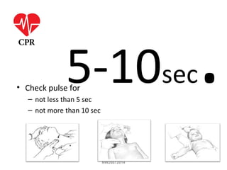 5-10sec.• Check pulse for
– not less than 5 sec
– not more than 10 sec
NW26072014
 