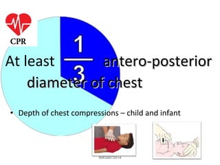 At least antero-posteriorantero-posterior
diameter of chestdiameter of chest
• Depth of chest compressions – child and infant
NW26072014
 