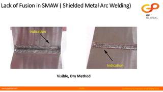 www.gpglobal.com Confidential & Proprietary © GP Global 2019
Lack of Fusion in SMAW ( Shielded Metal Arc Welding)
Visible, Dry Method
Indication
Indication
11/25
 