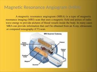 Magnetic Resonance Angiogram (MRA)
A magnetic resonance angiogram (MRA) is a type of magnetic
resonance imaging (MRI) scan that uses a magnetic field and pulses of radio
wave energy to provide pictures of blood vessels inside the body. In many cases
MRA can provide information that can't be obtained from an X-ray, ultrasound,
or computed tomography (CT) scan.
 