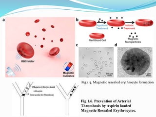 Fig 1.6. Prevention of Arterial
Thrombosis by Aspirin loaded
Magnetic Resealed Erythrocytes.
Fig 1.5. Magnetic resealed erythrocyte formation
 