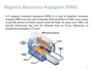 Magnetic Resonance Angiogram (MRA)
A magnetic resonance angiogram (MRA) is a type of magnetic resonance
imaging (MRI) scan that uses a magnetic field and pulses of radio wave energy
to provide pictures of blood vessels inside the body. In many cases MRA can
provide information that can't be obtained from an X-ray, ultrasound, or
computed tomography (CT) scan.
19
 