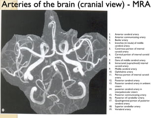 Arteries of the brain (cranial view) - MRA
1. Anterior cerebral artery
2. Anterior communicating artery
3. Basilar artery
4. branches (in insula) of middle
cerebral artery
5. Cavernous portion of internal
carotid artery
6. Cervical portion of internal carotid
artery
7. Genu of middle cerebral artery
8. Intracranial (supraclinoid) internal
carotid artery
9. Middle cerebral artery
10. Ophthalmic artery
11. Petrous portion of internal carotid
artery
12. Posterior cerebral artery
13. Posterior cerebral artery in ambient
cistern
14. posterior cerebral artery in
interpeduncular cistern
15. Posterior communicating artery
16. Posterior inf cerebellar artery.
17. Quadrigeminal portion of posterior
cerebral artery
18. Superior cerebellar artery
19. Vertebral artery
 
