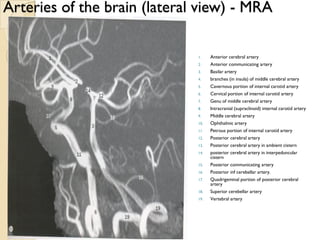 Arteries of the brain (lateral view) - MRA
1. Anterior cerebral artery
2. Anterior communicating artery
3. Basilar artery
4. branches (in insula) of middle cerebral artery
5. Cavernous portion of internal carotid artery
6. Cervical portion of internal carotid artery
7. Genu of middle cerebral artery
8. Intracranial (supraclinoid) internal carotid artery
9. Middle cerebral artery
10. Ophthalmic artery
11. Petrous portion of internal carotid artery
12. Posterior cerebral artery
13. Posterior cerebral artery in ambient cistern
14. posterior cerebral artery in interpeduncular
cistern
15. Posterior communicating artery
16. Posterior inf cerebellar artery.
17. Quadrigeminal portion of posterior cerebral
artery
18. Superior cerebellar artery
19. Vertebral artery
 