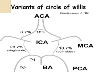 Variants of circle of willis
Krabbe-Hartmann et al 1998
 