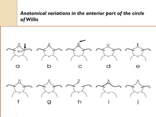 Anatomical variations in the anterior part of the circle
of Willis
 