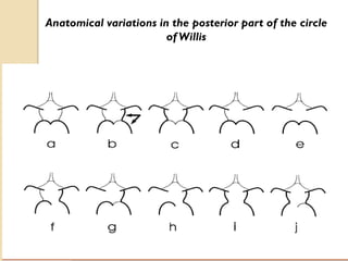 Anatomical variations in the posterior part of the circle
of Willis
 